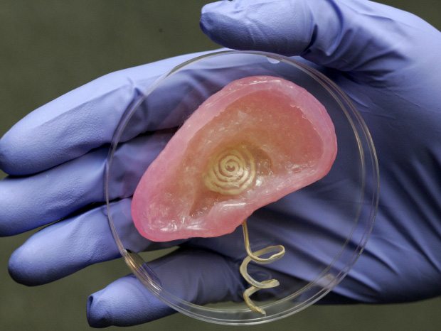 2_ Des chercheurs fabriquent l’oreille du futur en combinant du cartilage avec une antenne